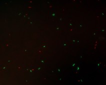 Photo Microscopie à épifluorescence (Live & Dead)