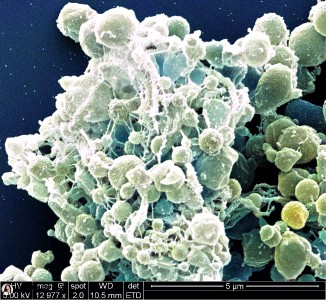 Biofilm d’un micro-organisme issu d’un réservoir pétrolier.